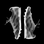 Running spikes footwear, X-ray