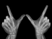 Whatever hands gesture, X-ray