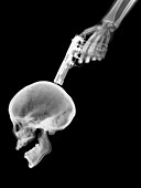Gun to skull, X-ray