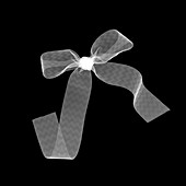 Ribbon bow, X-ray