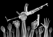 Hands of protesters with guns, X-ray