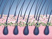 Fungal infection and dandruff, illustration