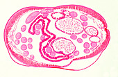 Giant roundworm female, light micrograph