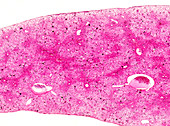 Frog liver, light micrograph