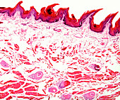 Trichinella parasite in polar bear muscle, light micrograph