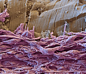 Organ of Corti nerve cells, SEM