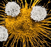 T-cells and lung cancer cell, SEM