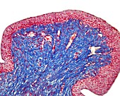 Urinary bladder mucosa, light micrograph