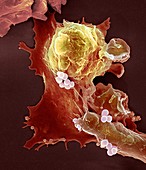 Neutrophil engulfing Staphylococcus aureus bacteria, SEM