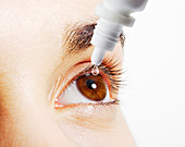 Woman putting eye drops into eye