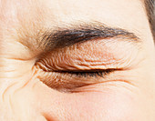 Extreme close up of girl squinting eye