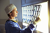 Surgeon reviewing MRI scans