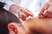 Acupuncturist applying acupuncture needle