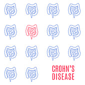 Crohn's disease, conceptual illustration