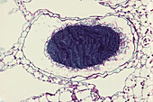 Common liverwort male sex organ, light micrograph