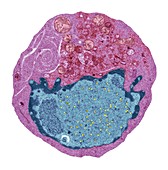 Hybridoma cell, TEM