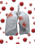 Covid-19 infection, conceptual illustration