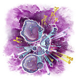 Tumor Lysis Syndrome, Illustration