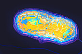 Escherichia coli bacteria, TEM