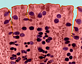Colon Cells LM