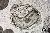 Megakaryocytes and Erythrocytes, EM