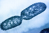 Klebsiella pneumoniae Bacteria , TEM