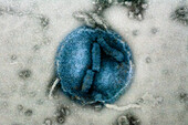 Influenza B Virus, TEM