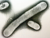 Acinetobacter Bacteria, TEM