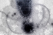 Bacterial Flagella, EM