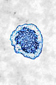 Nipah virus, TEM