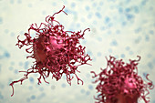 Cervical cancer cells, illustration
