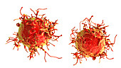 Skin cancer cell, illustration