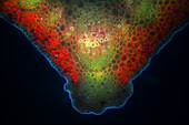 Angelical stem, UV fluorescence micrograph