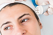 Micro dermabrasion of the face skin