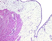 Pericardium of human heart, light micrograph