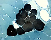 Adipocytes, light micrograph