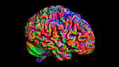 Human brain, diffusion MRI scan