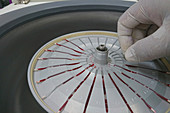 Haematocrit centrifuge