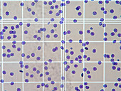 Blood cells in counting chamber