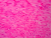 Human smooth muscle, light micrograph