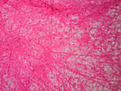 Human areolar tissue, light micrograph