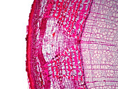 Plant stem, light micrograph