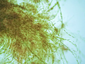 Filamentous algae, light micrograph