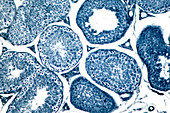 Human testis, light micrograph