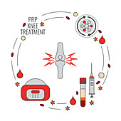 Platelet-rich plasma treatment, illustration