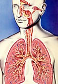 Upper and lower respiratory tract infections, illustration