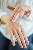 Woman applying cream on hands