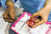 Kidney surgery