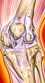 Osteoarthritis of the knee, illustration