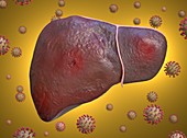 Liver inflammation in Covid-19, conceptual illustration